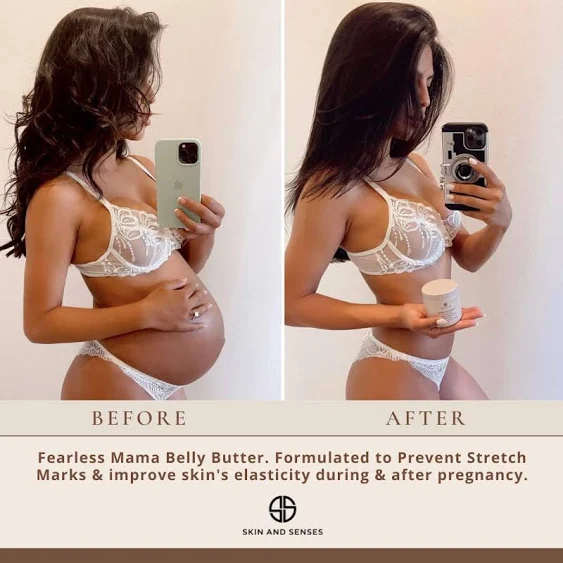 Skin and Senses Fearless Mama Stretch Mark Prevention Belly Butter for Pregnancy - 100% Natural Loaded with Ingredients That Nourish & Moisturize.