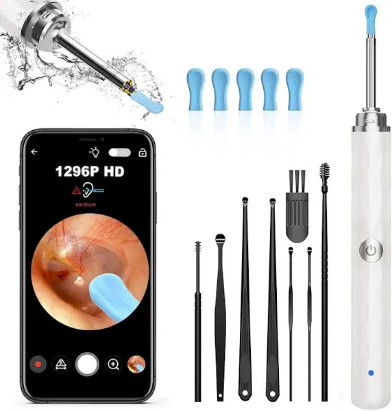 Loyker Ear Wax Removal, Ear Cleaner with Camera, Ear Wax Removal Tool Camera with 1080p, Otoscope with Light, Ear Wax Removal Kit with 6 Ear Pick, Ear Camera