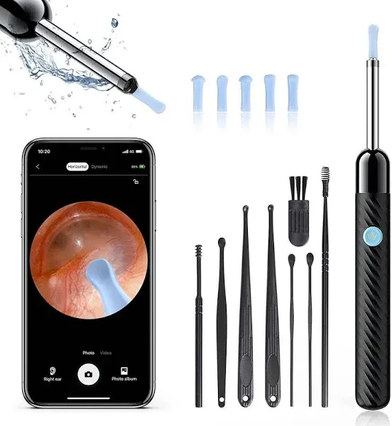 Ear Wax Removal Tool, Ear Cleaner with Camera, Otoscope with Light, Ear Wax C...