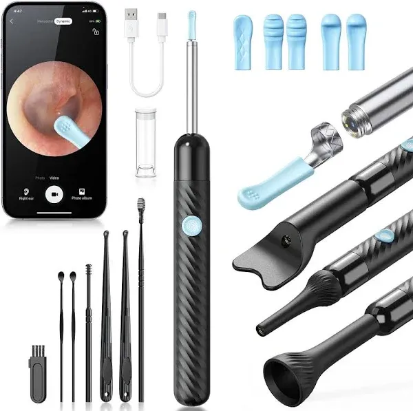 Loyker X6 Ear Wax Removal Tool Camera